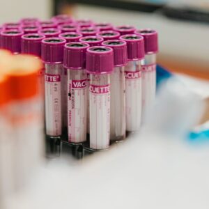 Entdecken Sie die Wichtigkeit von Bluttests und Behandlungen für Blutkrankheiten durch unser Fachärzteteam für optimale Blutgesundheit.